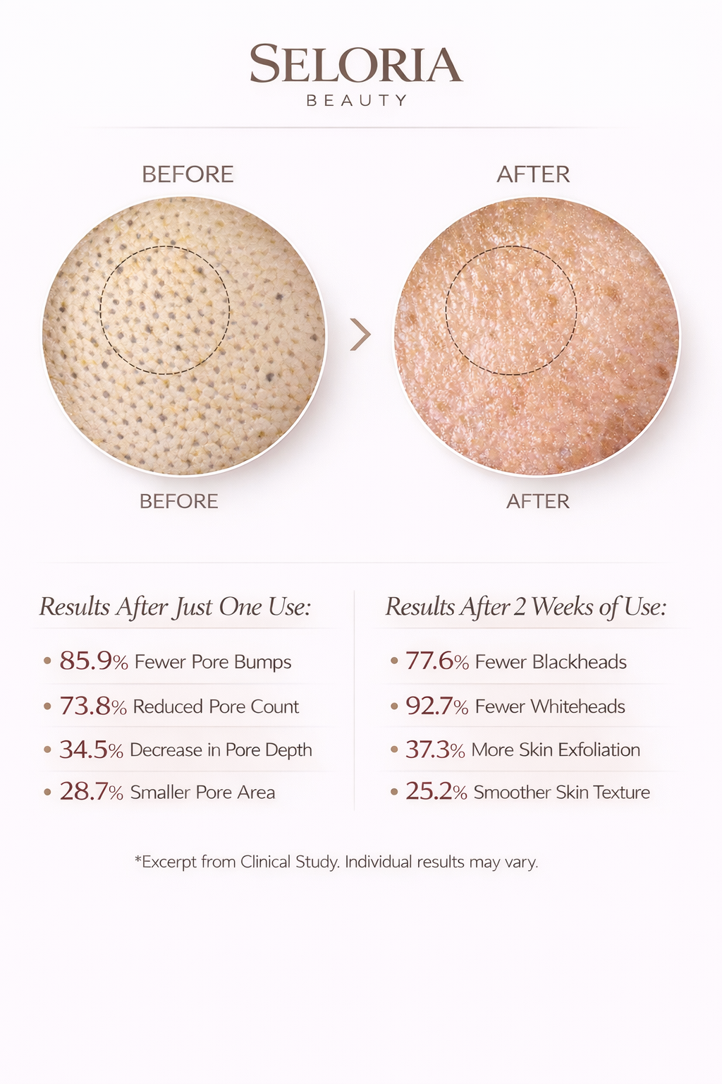 Seloria Beauty Rice Peel Serum Ampoule™