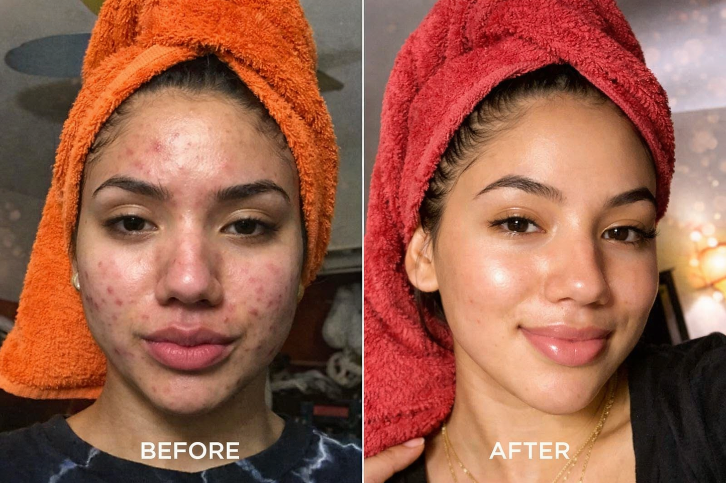 Seloria Beauty Rice Peel Serum Ampoule™