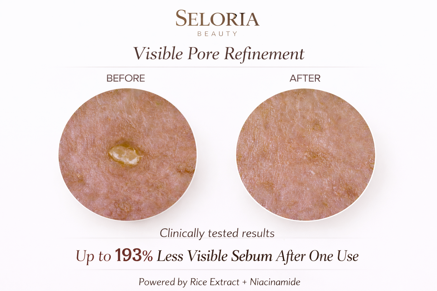 Seloria Beauty Rice Peel Serum Ampoule™